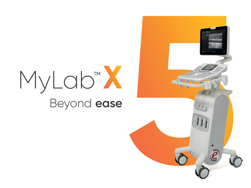 mylab-X5-overview-01-new